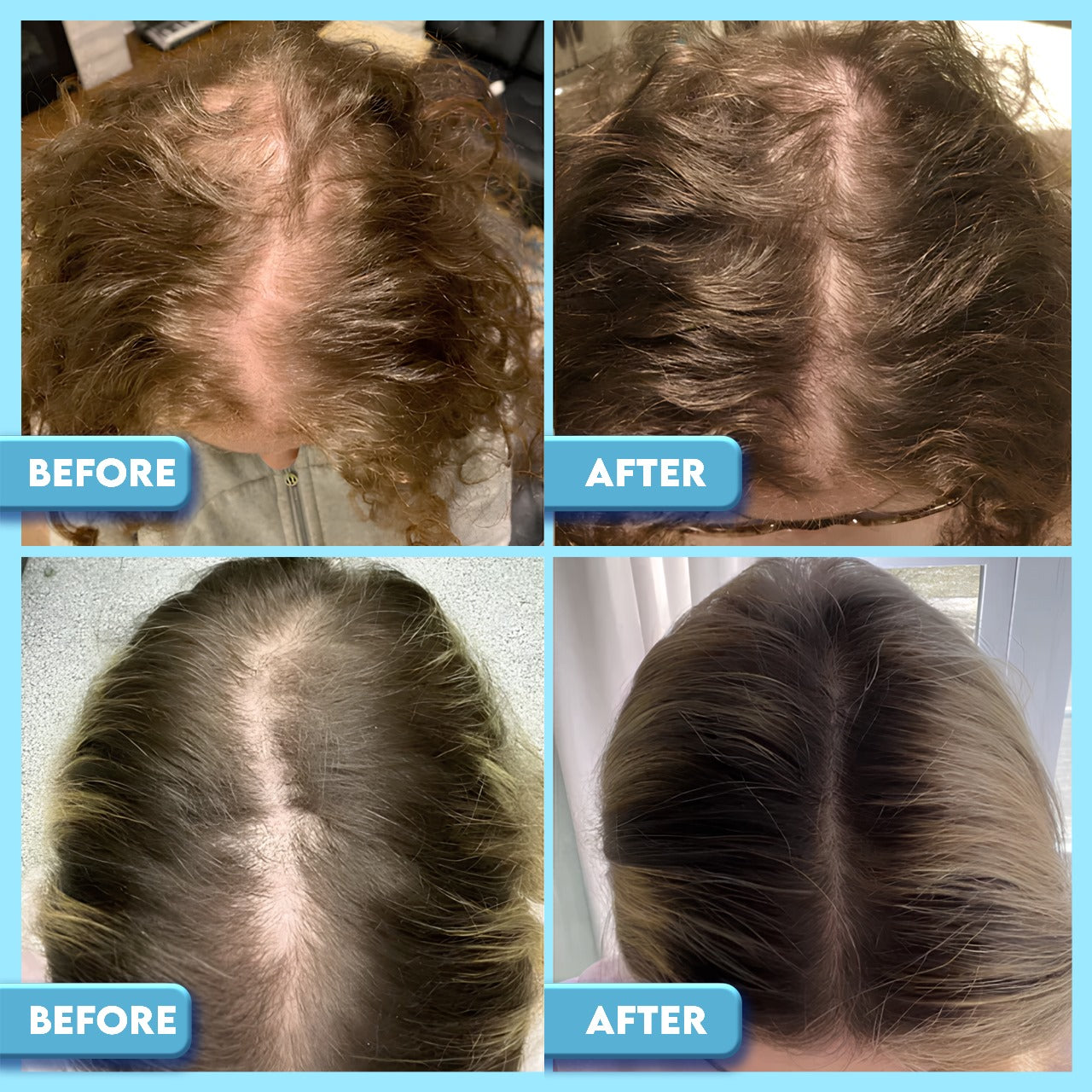 Prestique™-Natural Hair Growth Oil