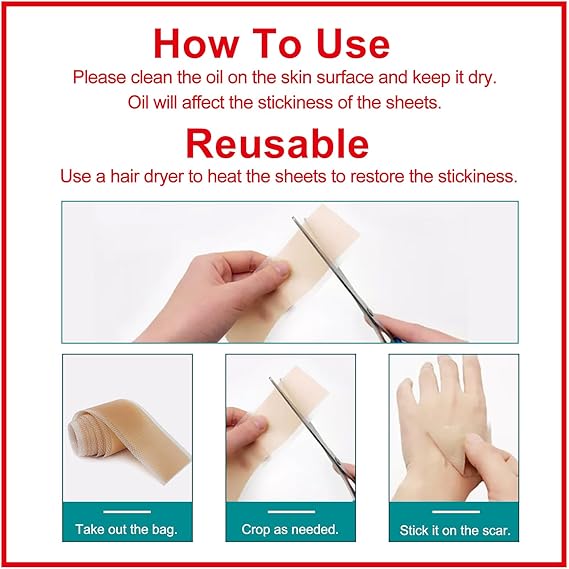 Prestique Silicone Scar Sheets