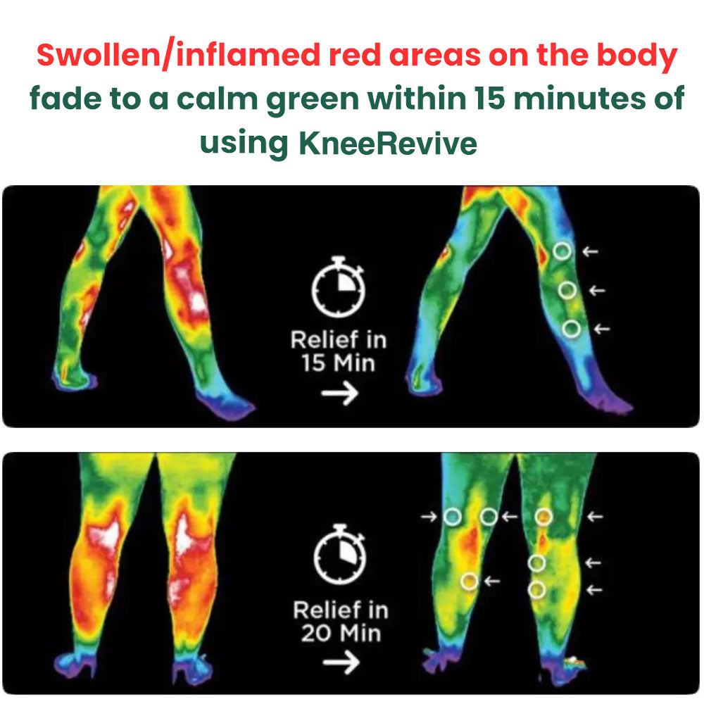 RejuvaKnee Knee Relief