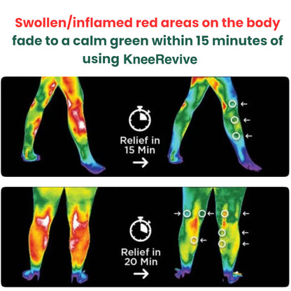 RejuvaKnee Knee Relief