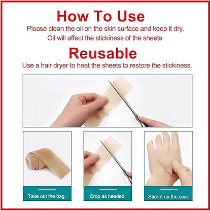 Prestique Silicone Scar Sheets